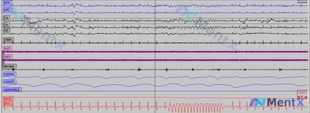 Post 93 image 1