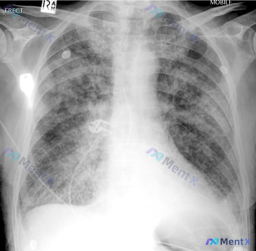 Post 1164 image 1