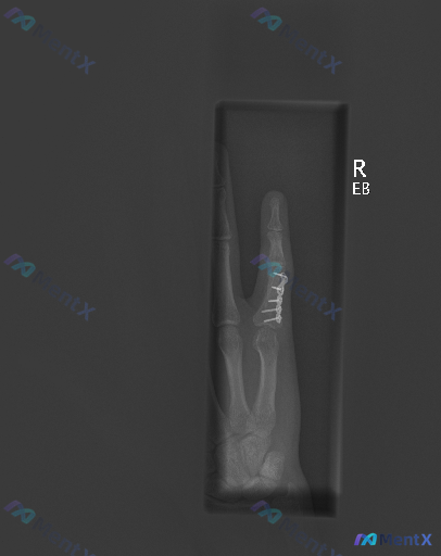 Post Image 1