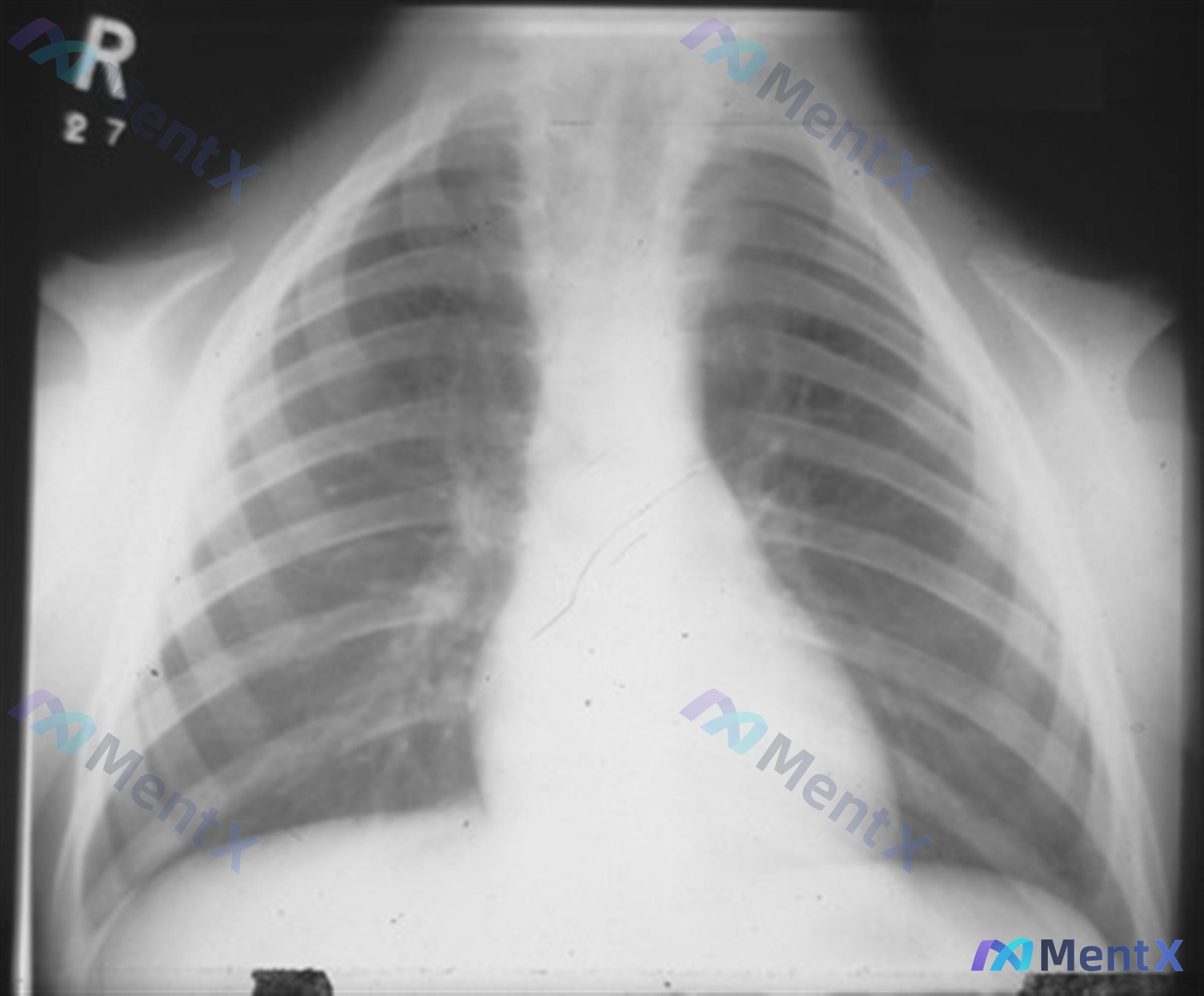 Post Image 5
