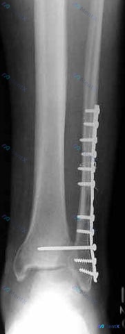 Post 2673 image 1