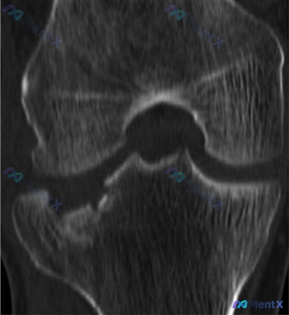 Post Image 5