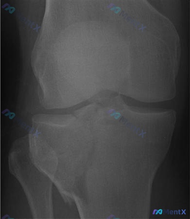 Post 1990 image 4