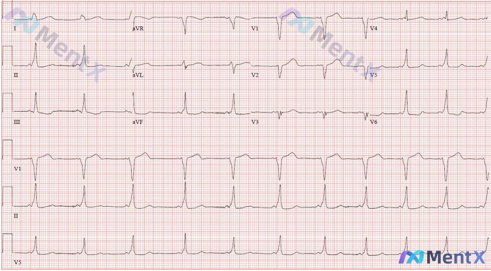 Post 230 image 1