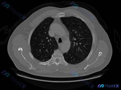 Post 2093 image 1