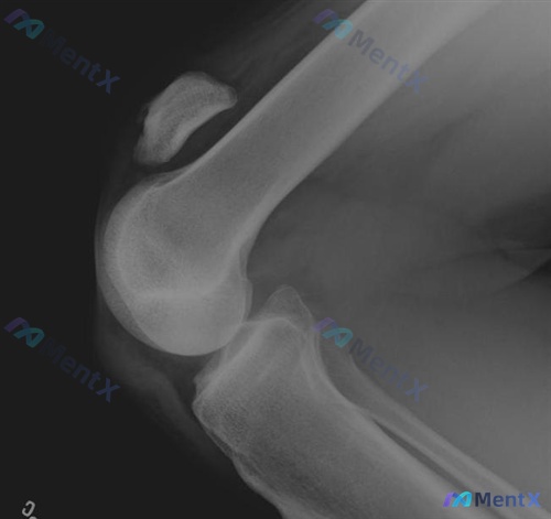Post 1701 image 2