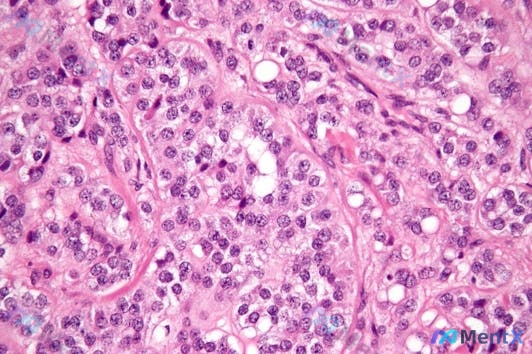 Post 156 image 2