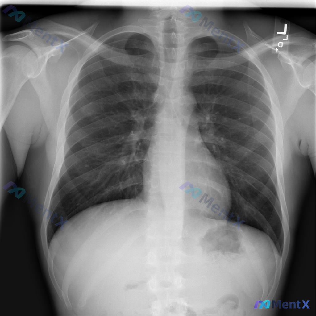 Post 2120 image 1