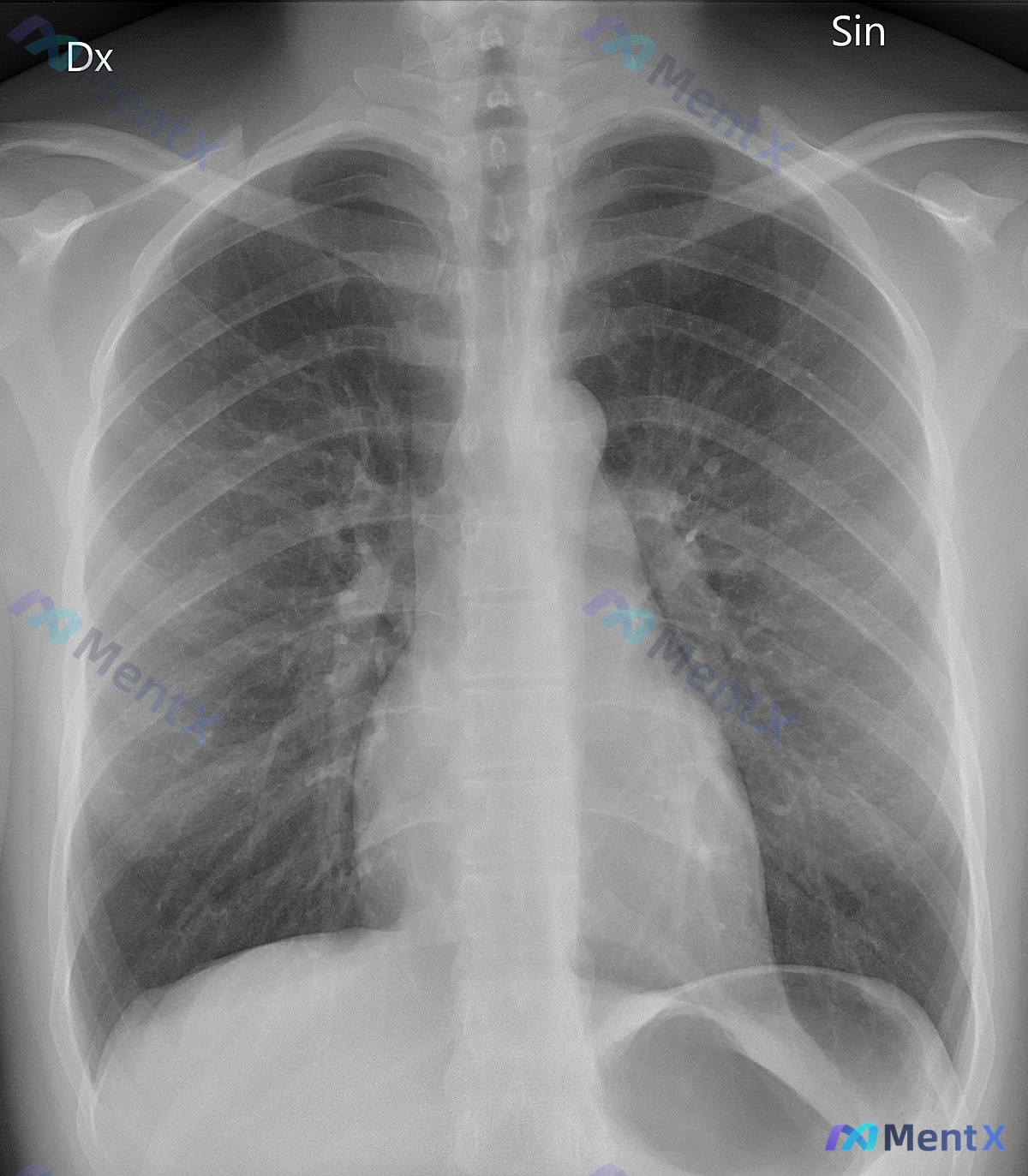 Post 2962 image 1