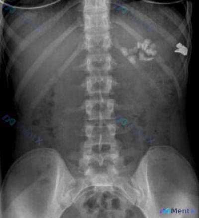 Post 2042 image 1