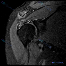Post 27452 image 1