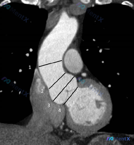 Post 2057 image 1