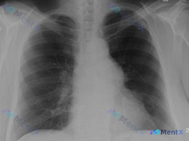 Post 1310 image 1