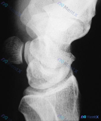 Post 1730 image 2