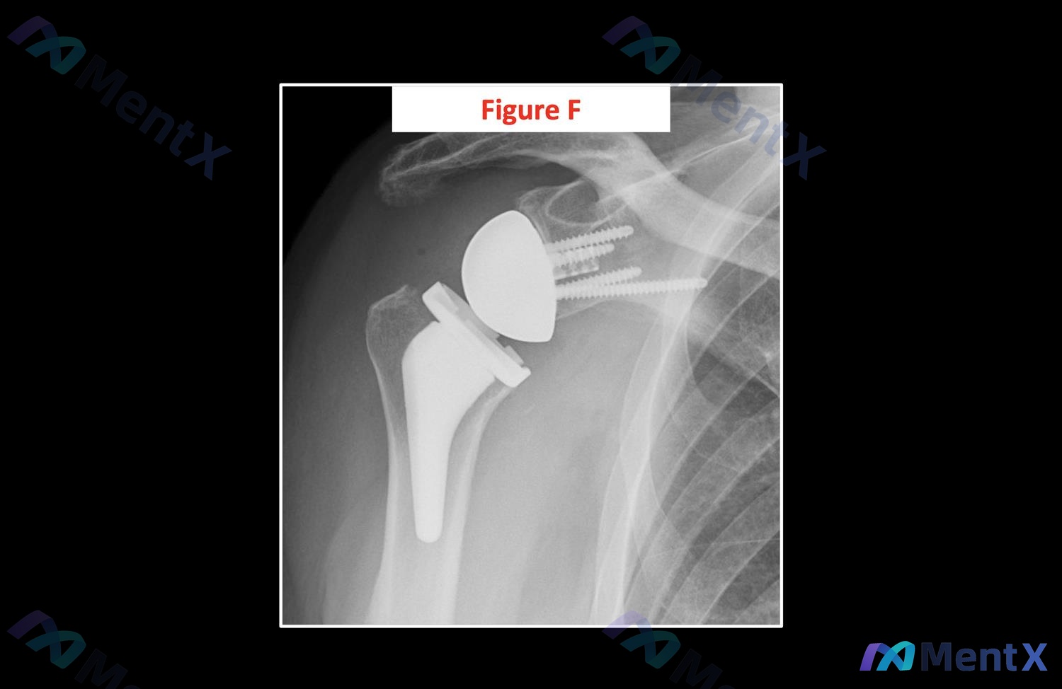 Post Image 6