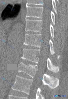 Post 1407 image 1