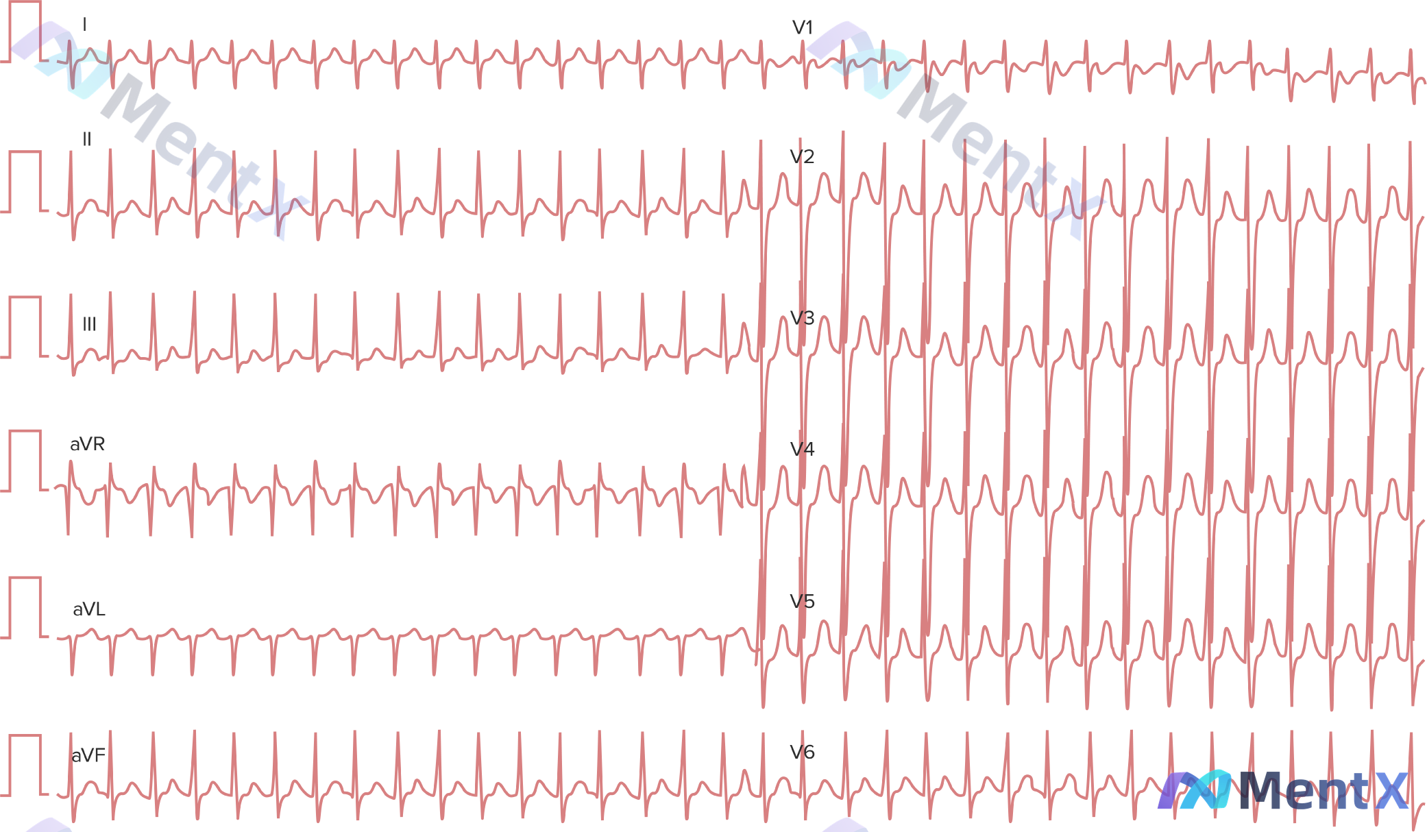 Post 2241 image 1