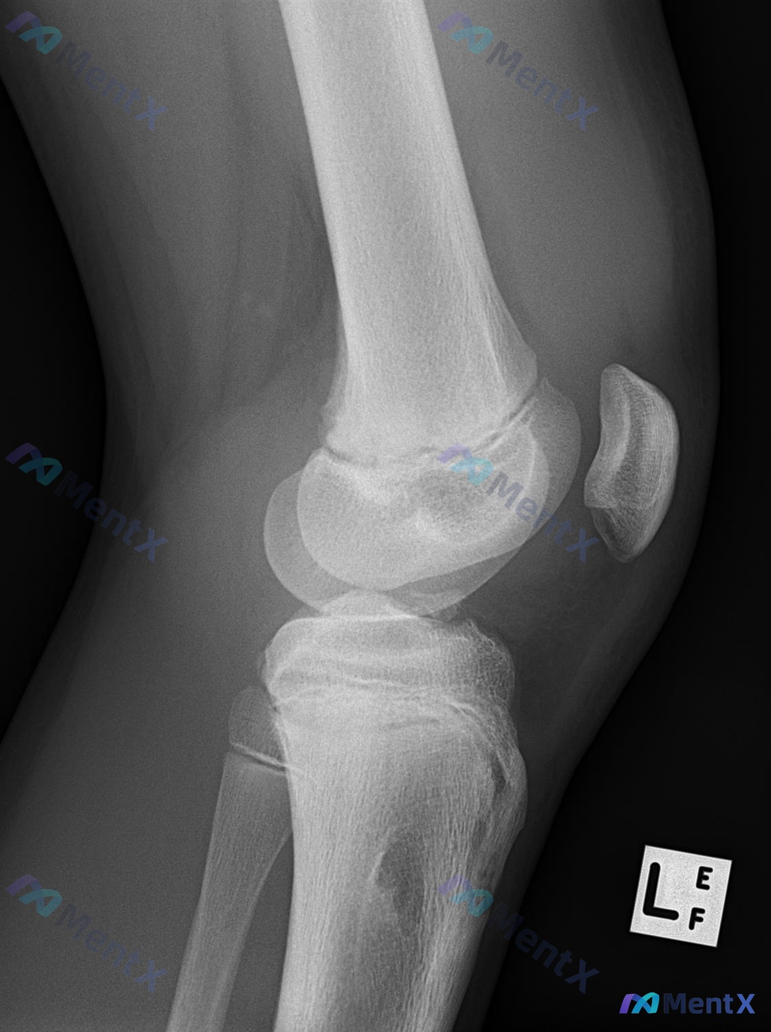 Post Image 5