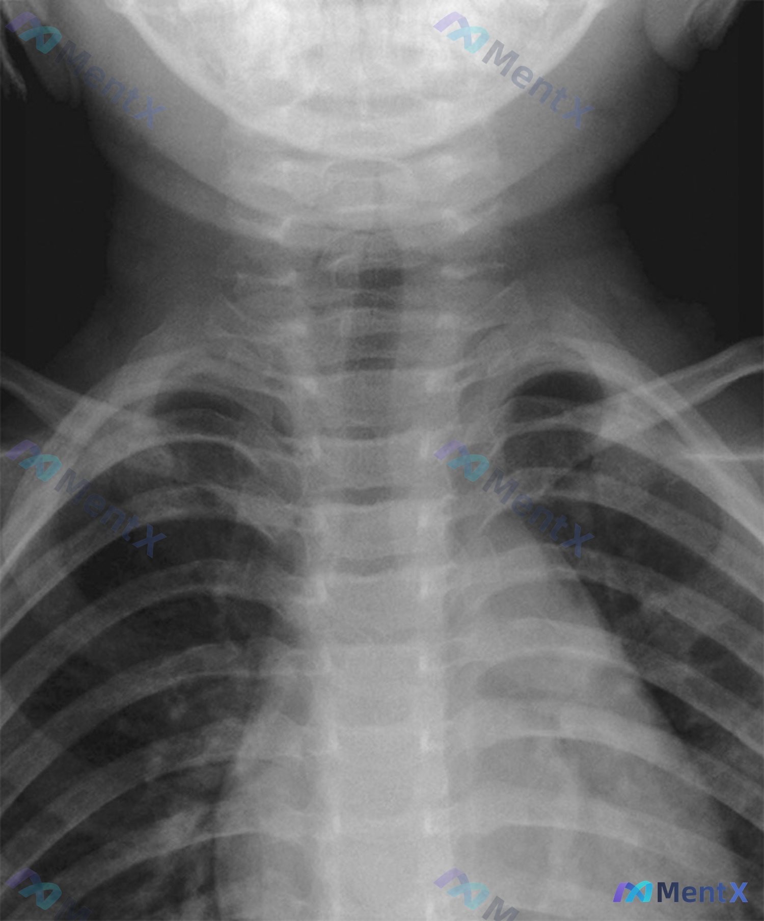 Post 1691 image 1