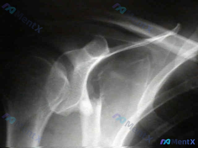 Post 1204 image 1