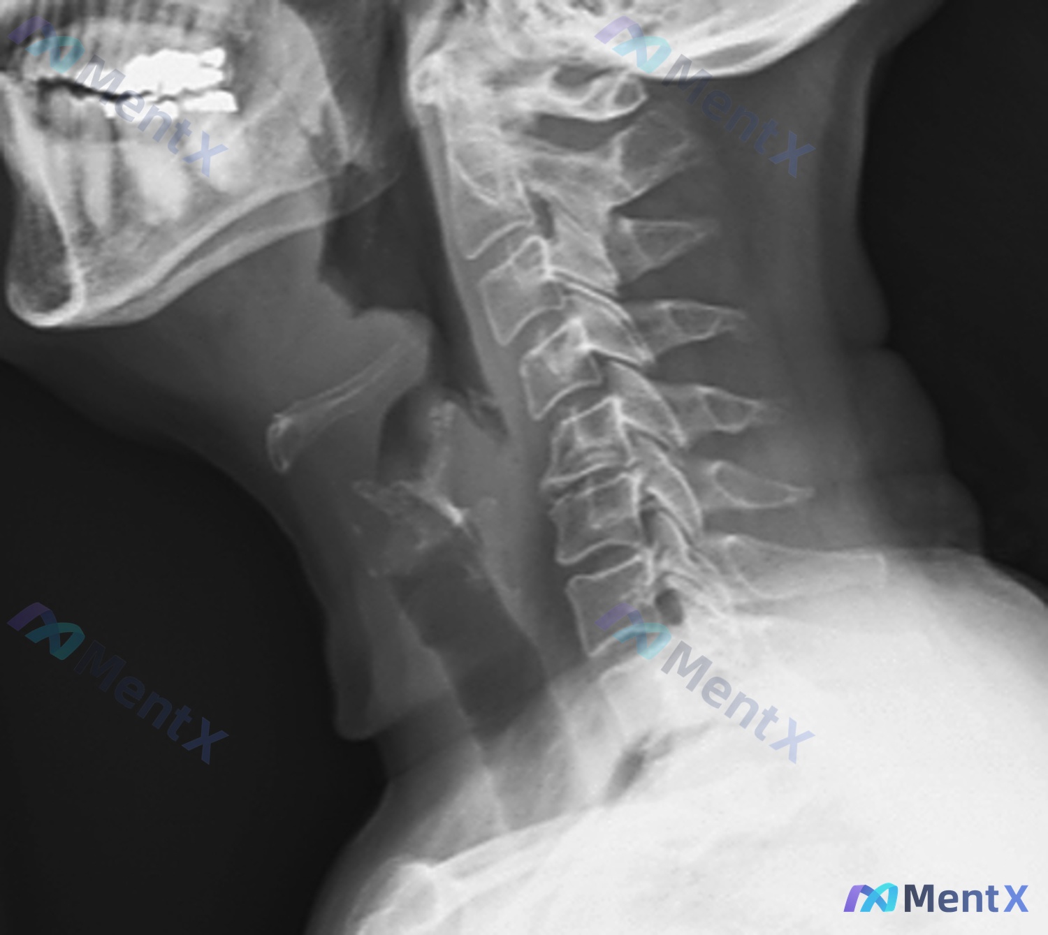 Post 15 image 1