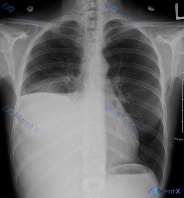 Post 2004 image 1