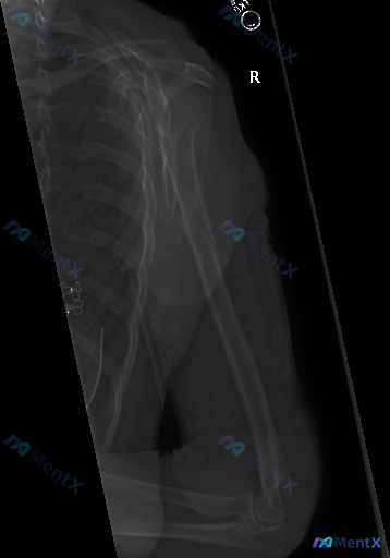 Post 5150 image 1