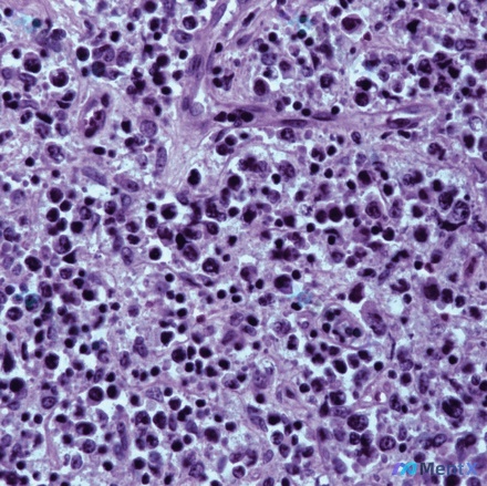 Post 2060 image 4