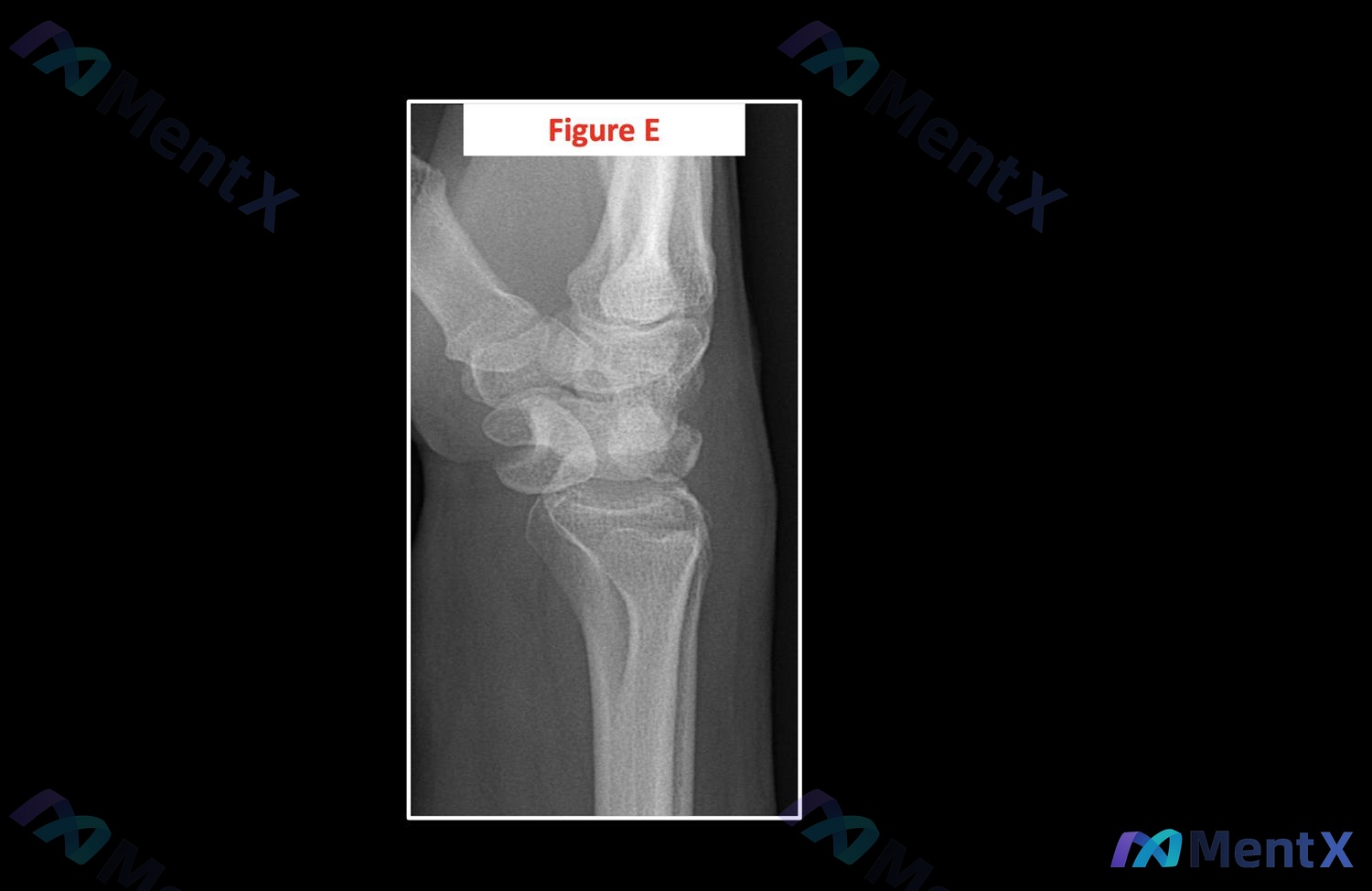 Post Image 5