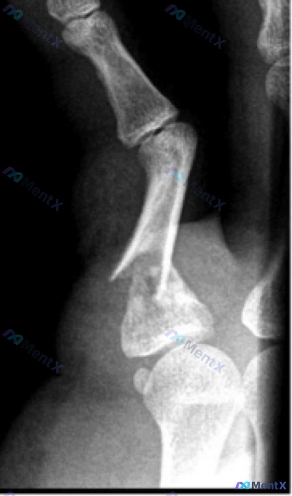 Post 507 image 1