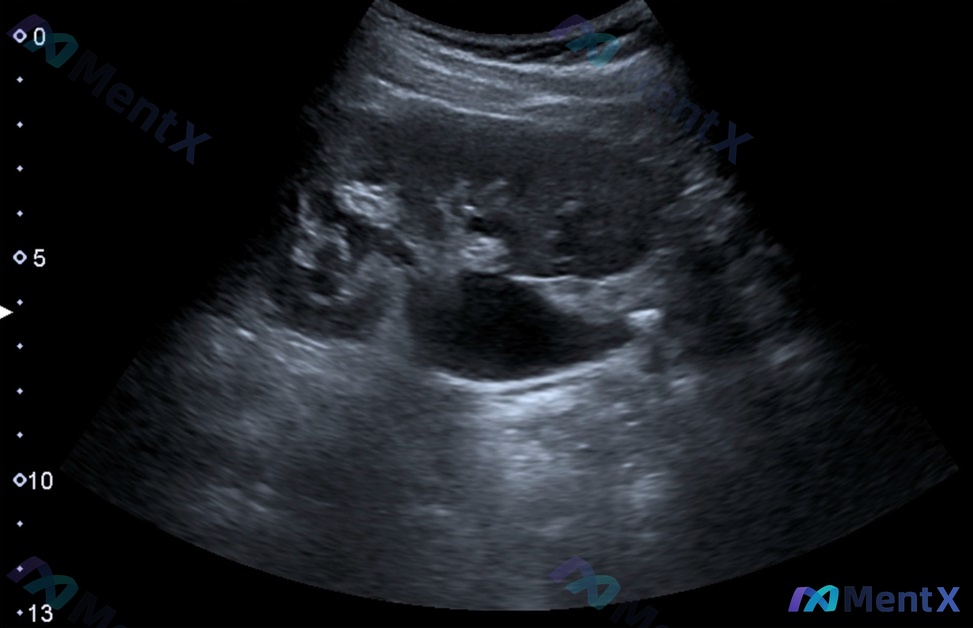 Post 210 image 1