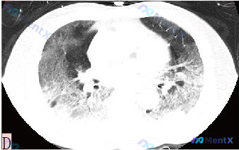 Post 509 image 1