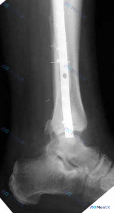 Post 2673 image 2