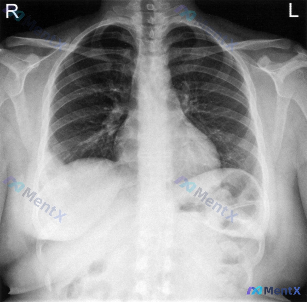 Post 251 image 1