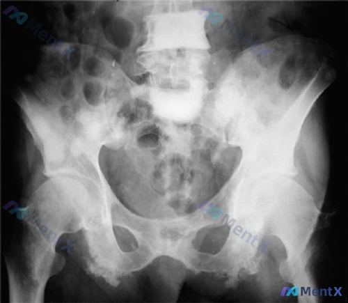Post 1308 image 1