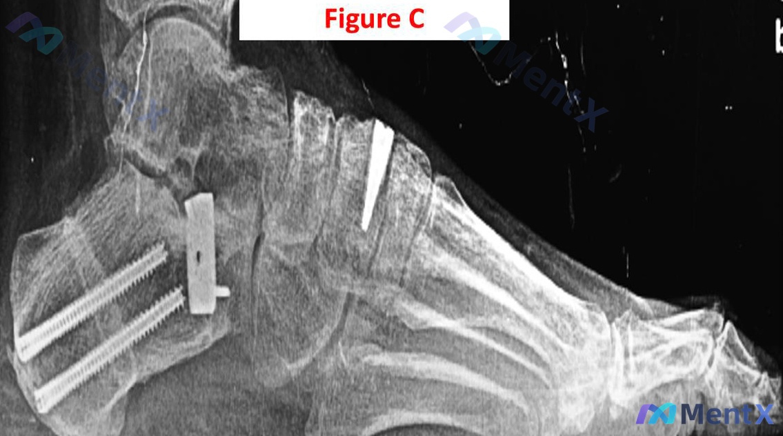 Post Image 3