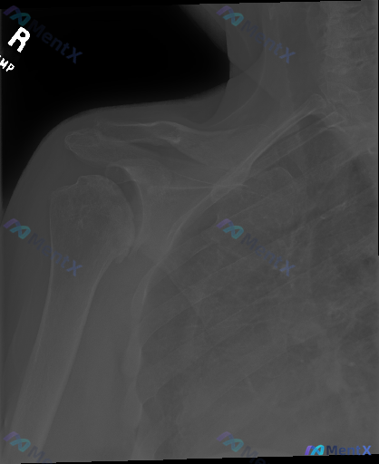 Post 3824 image 1