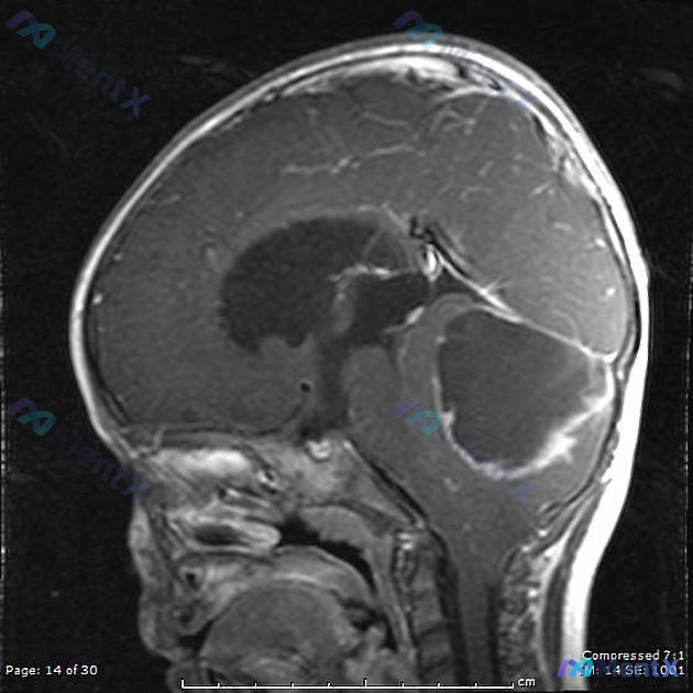 Post 877 image 1