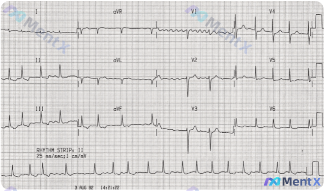 Post 1318 image 1