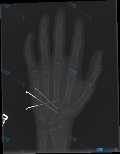 Post Image 1