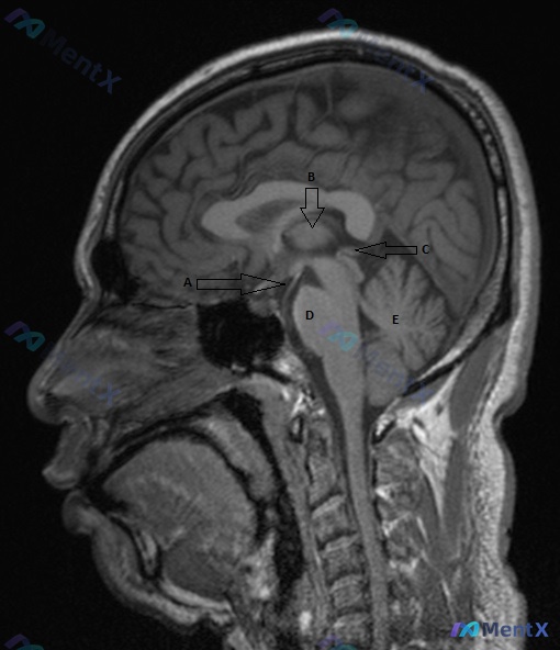 Post 1737 image 1
