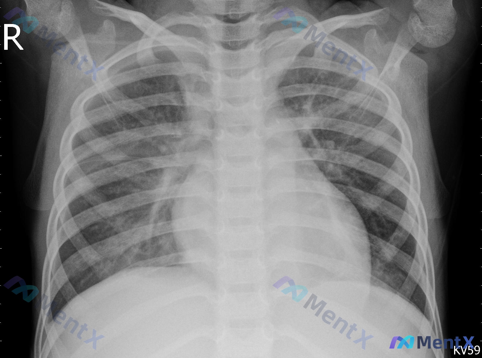 Post 2230 image 1
