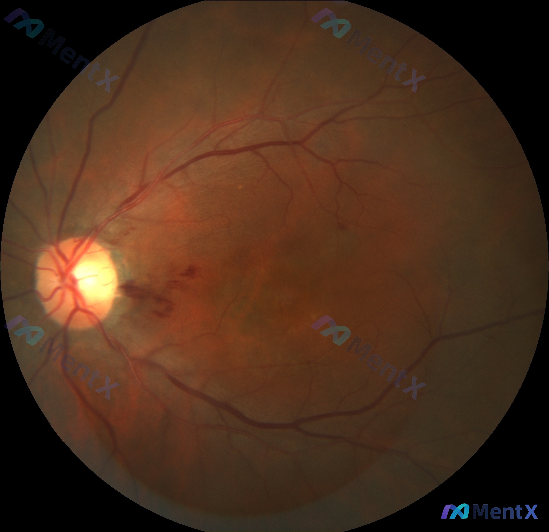 Post 4715 image 1