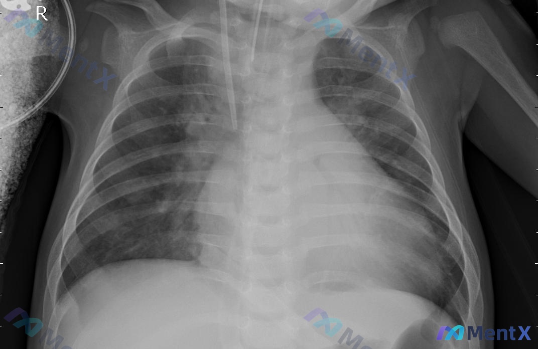 Post 860 image 1