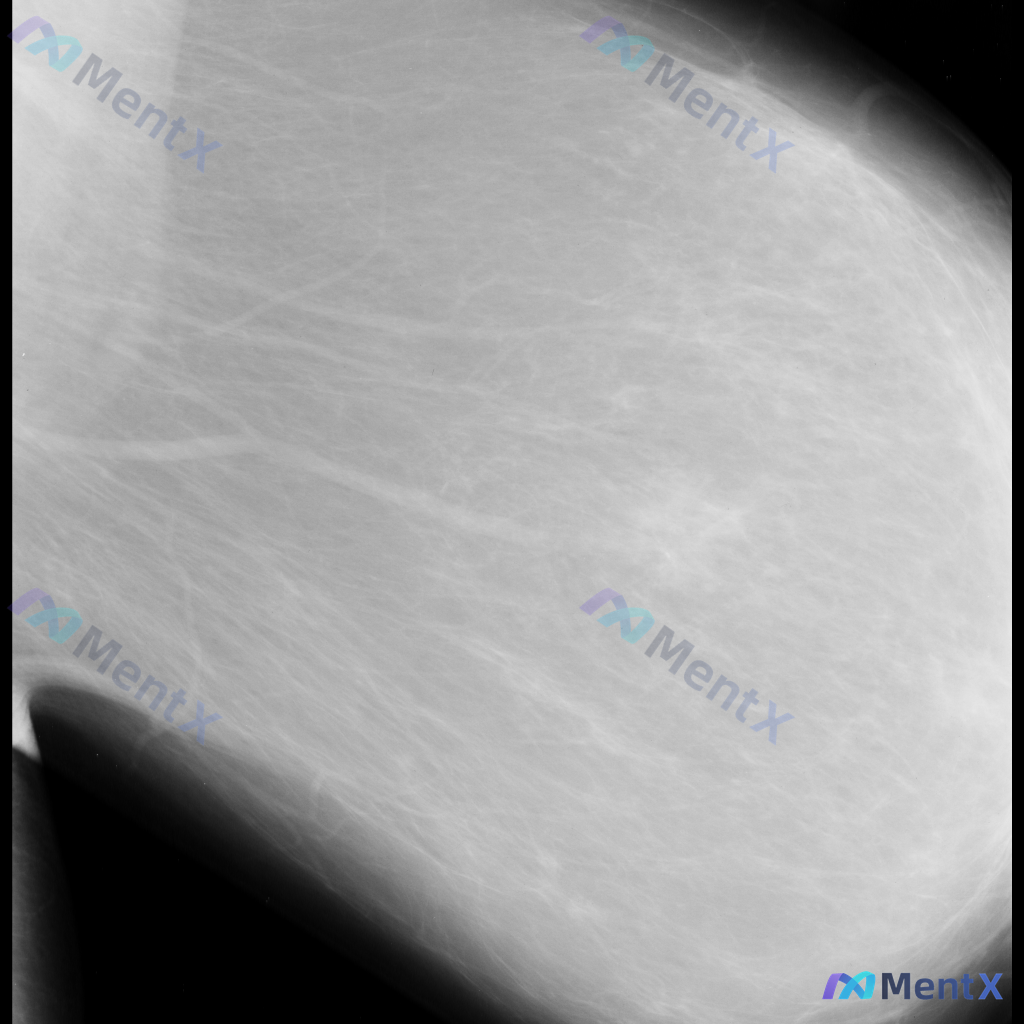 Post 3600 image 1