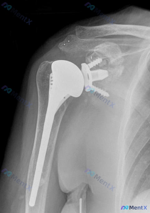 Post Image 6