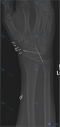 Post 5107 image 1