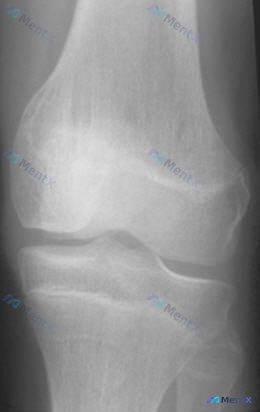 Post 162 image 2