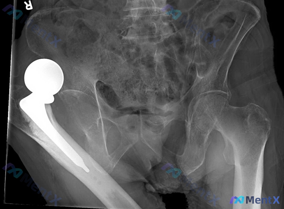 Post 1678 image 3