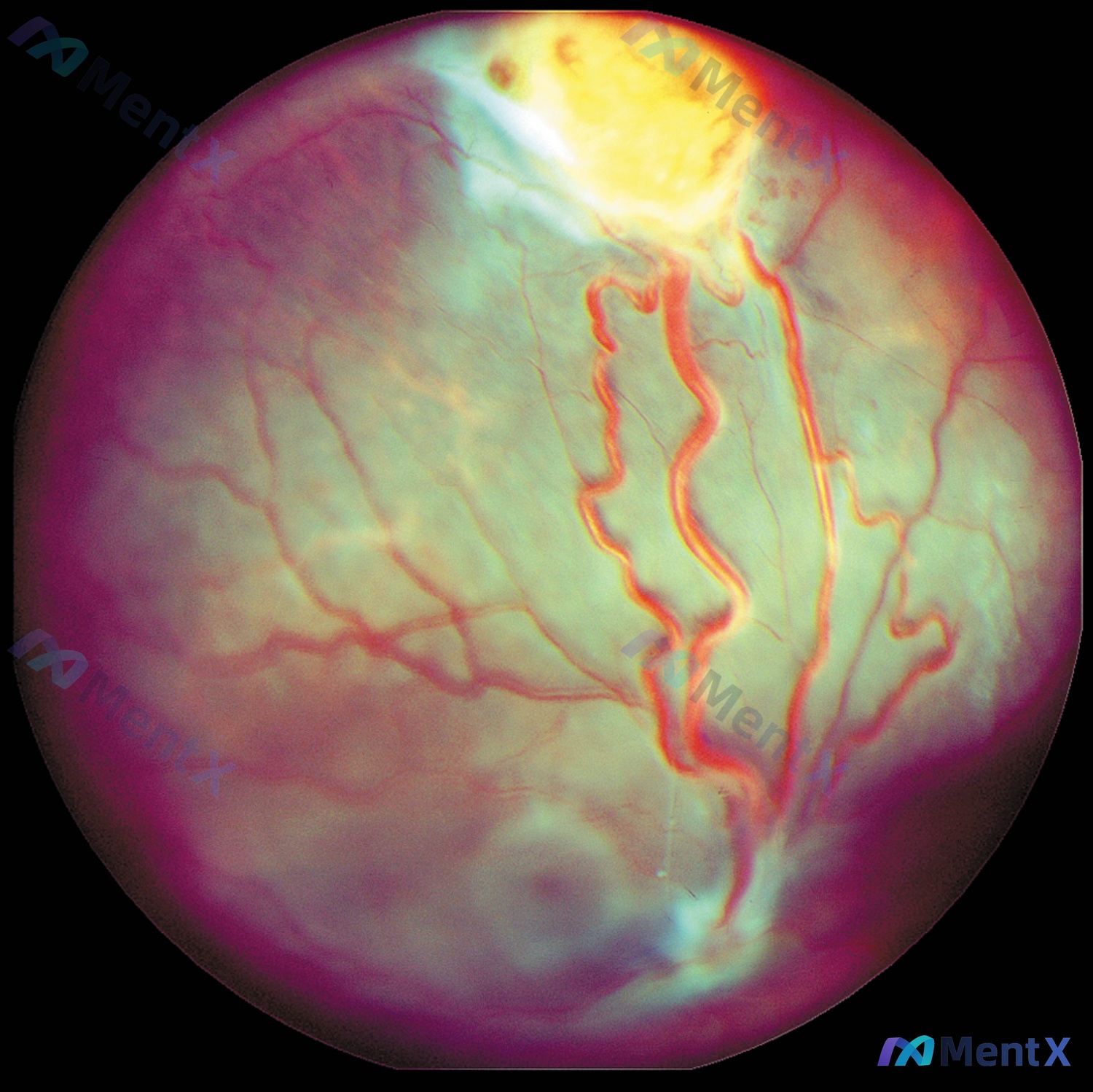 Post 1100 image 1
